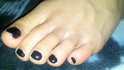Macro Closeup Of Amateurs Black Toenails